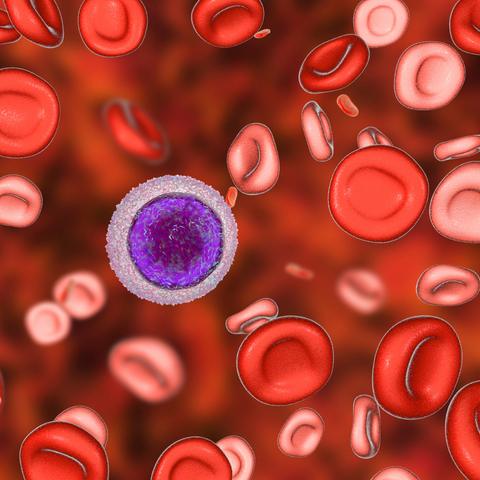 Eisen-Mangel - Was ist das?